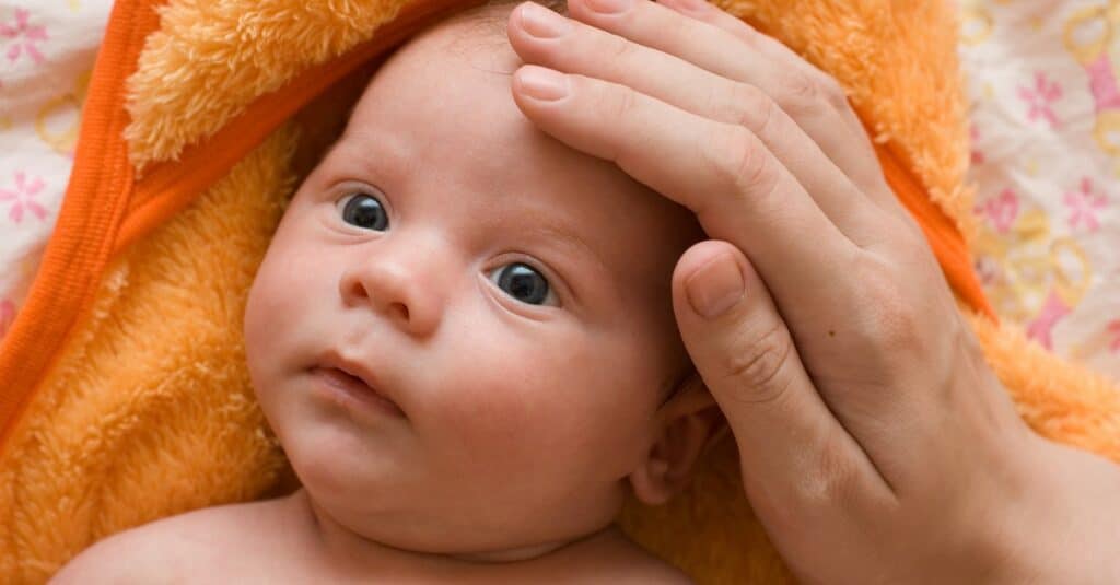 home remedies for cradle cap