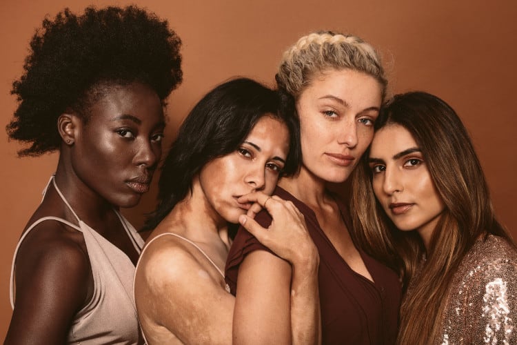 women different skin types