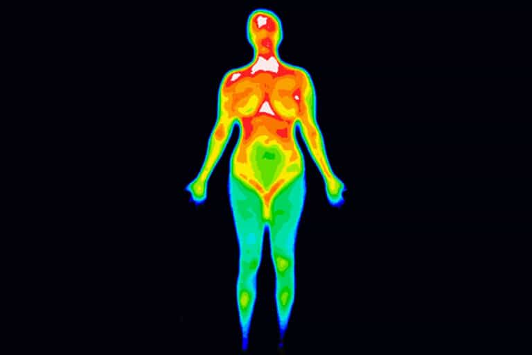 Medical Thermography: Benefits and Uses