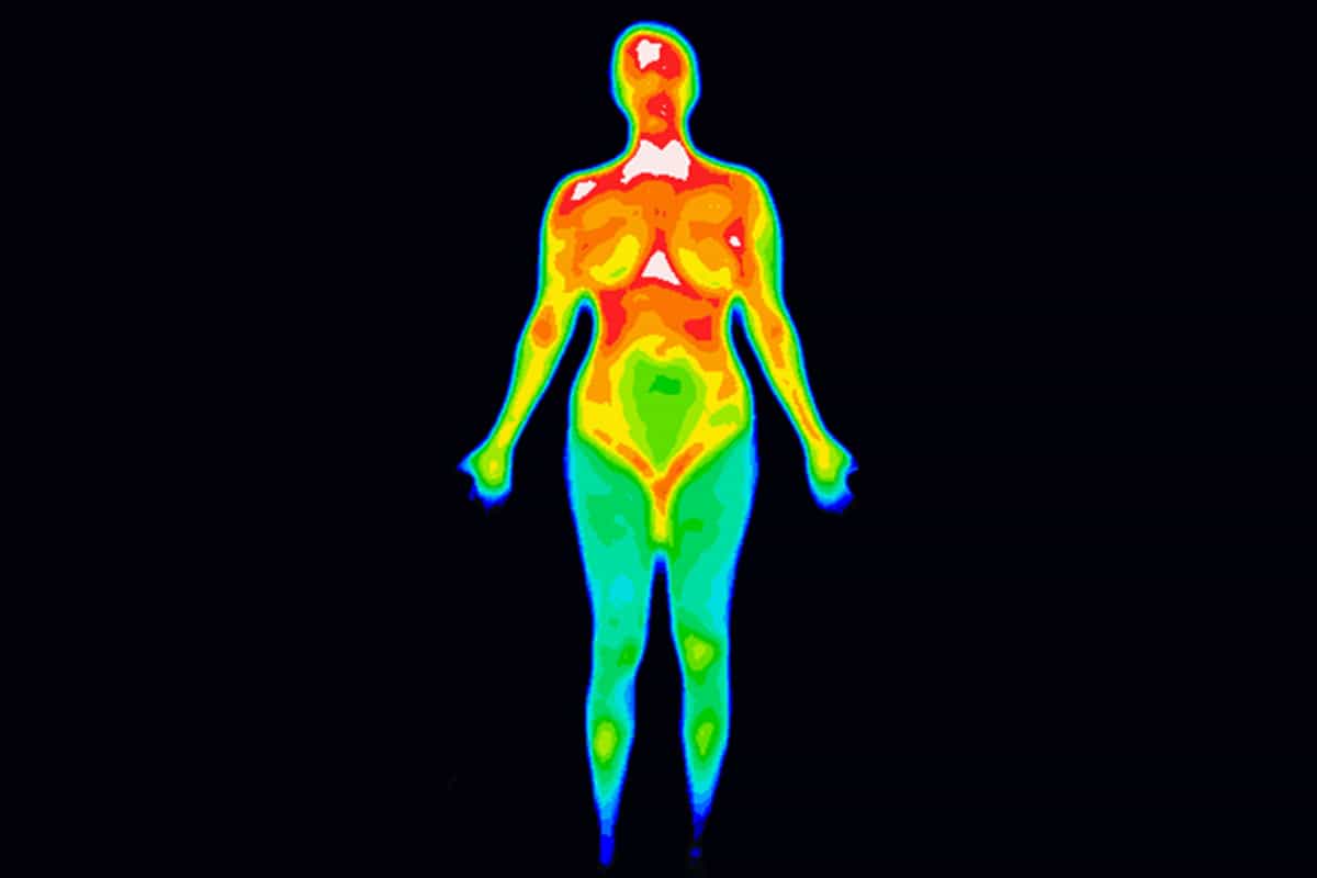 medical thermography scan
